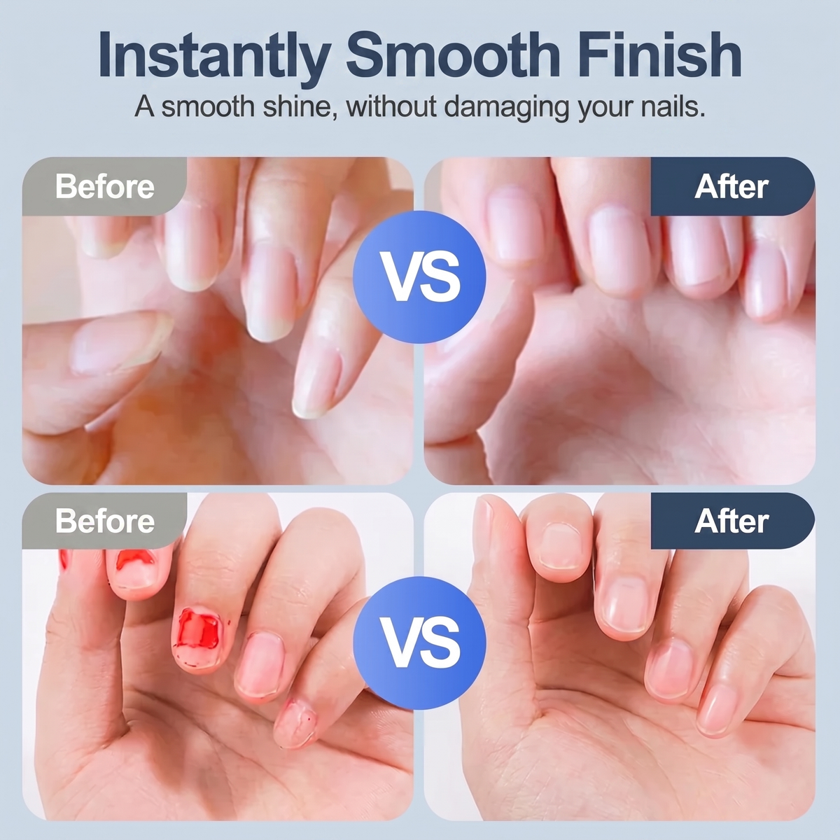 Nailora™ - Safe & Easy Electric Nail Care for Adults & Children