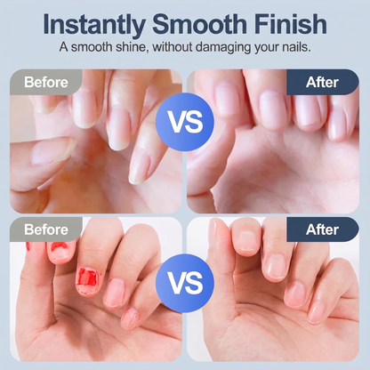 Nailora™ - Safe & Easy Electric Nail Care for Adults & Children